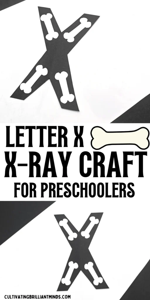 a letter x craft that has a black x with white bones to look like an x-ray