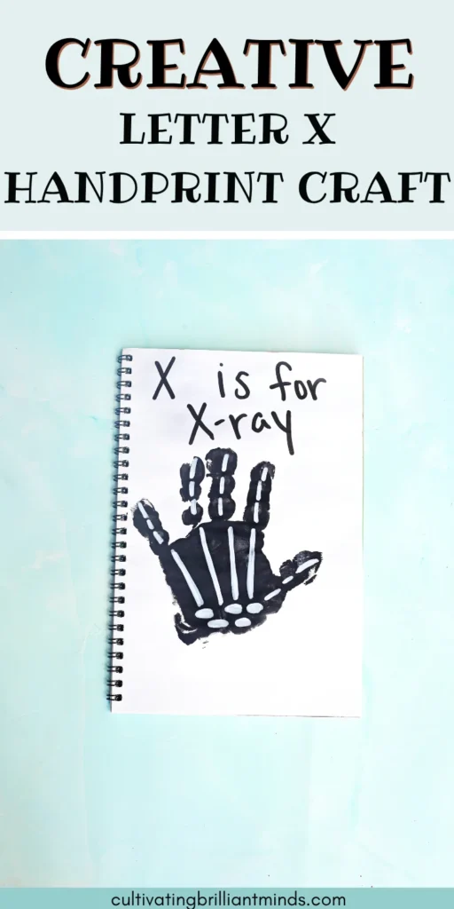 a black handprint with white bones with text that reads "x is for xray"