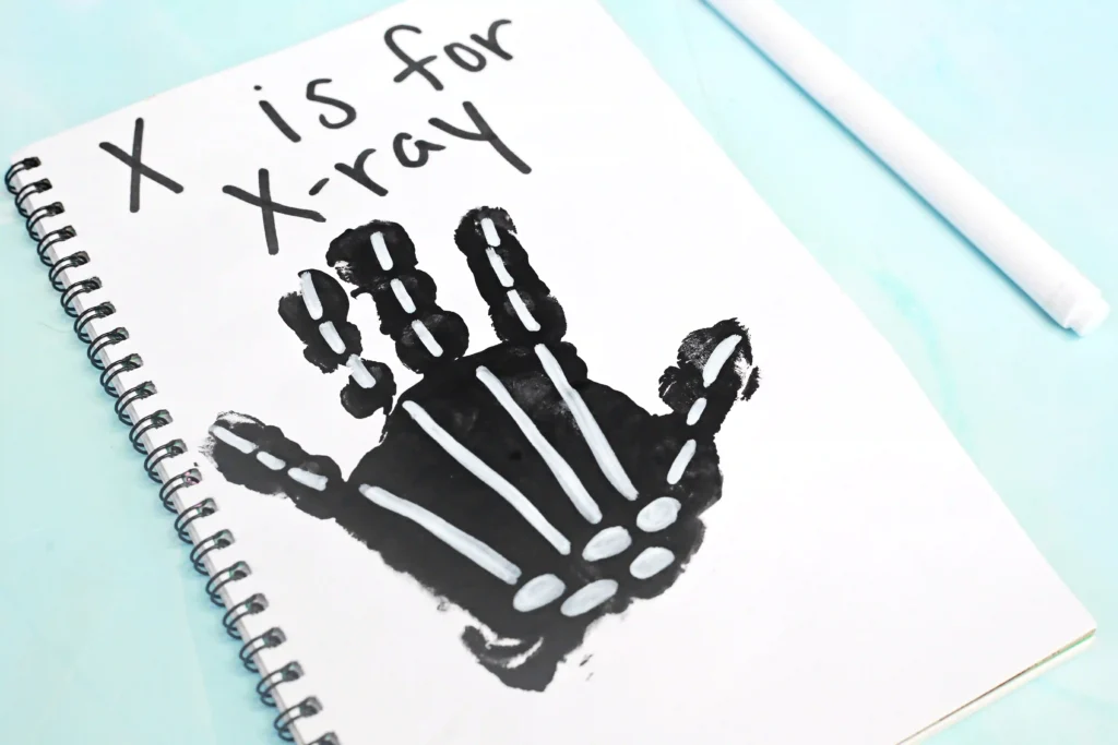 a black handprint with white bones with text that reads "x is for xray"