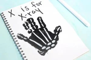 a black handprint with white bones with text that reads "x is for xray"
