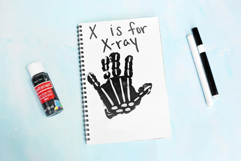 a black handprint with white bones with text that reads "x is for xray"