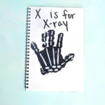 a black handprint with white bones with text that reads "x is for xray"