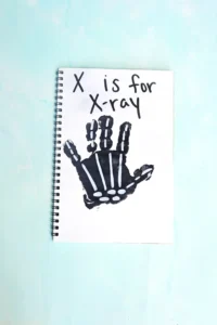 a black handprint with white bones with text that reads "x is for xray"