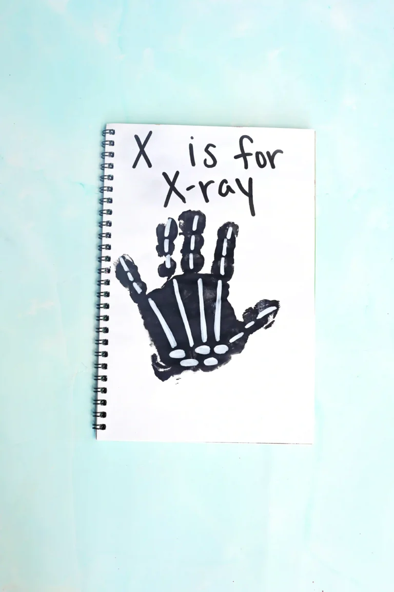 a black handprint with white bones with text that reads "x is for xray"