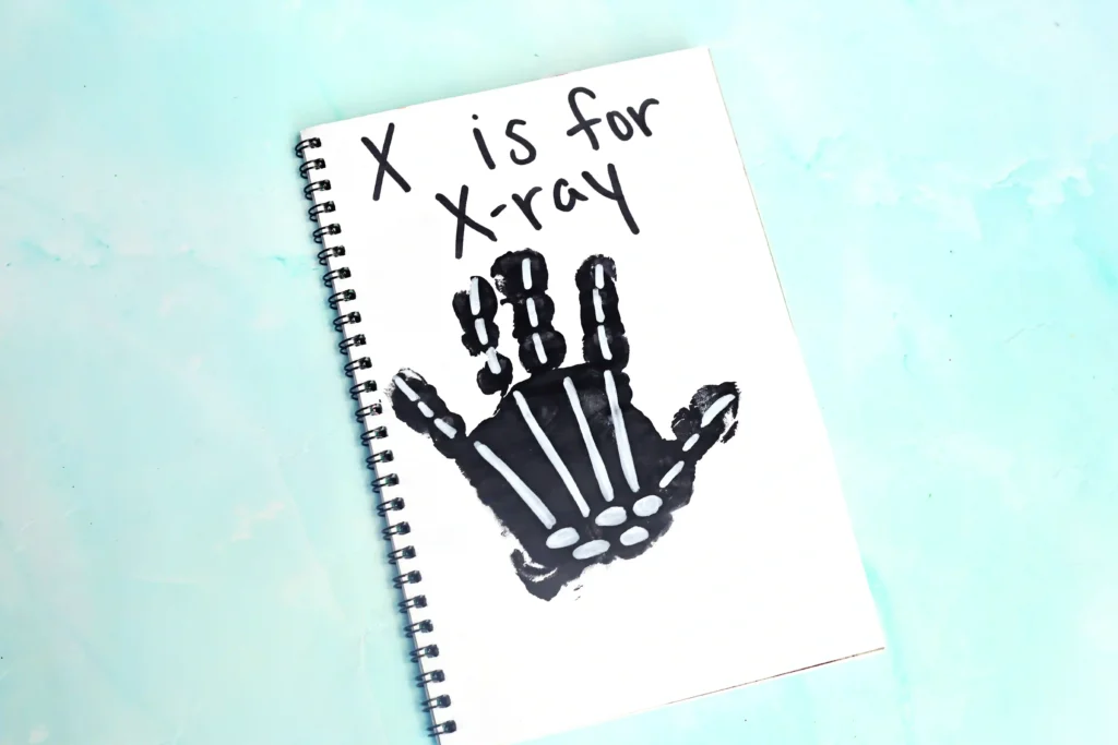 a black handprint with white bones with text that reads "x is for xray"