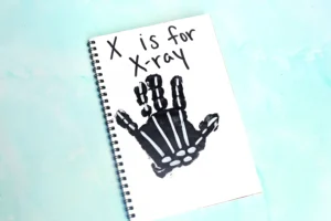 a black handprint with white bones with text that reads "x is for xray"